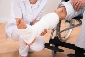 doctor holding patient's broken leg in a cast